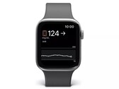 Apple Horlogegebruikers kunnen hun bloedsuikerspiegel al bijhouden met Dexcom-apparaten. (Afbeeldingsbron: Dexcom)