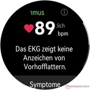 Resultaat ECG-functie