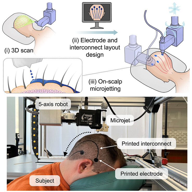 Een microjet gemonteerd op een robotarm spuit biocompatibel, geleidend materiaal op de hoofdhuid om elektrische verbindingen te vormen, ter vervanging van een EEG kapje. (Afbeeldingsbron: Vasconcelos et al. in Cell Biomaterials)